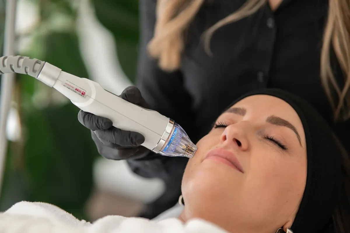 Skin Remodeling – strukturelle Hauterneuerung Bad Sassendorf