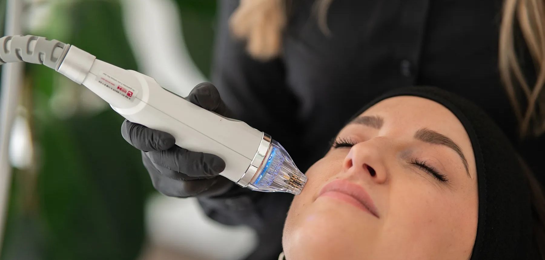 Skin Remodeling – strukturelle Hauterneuerung Bad Sassendorf