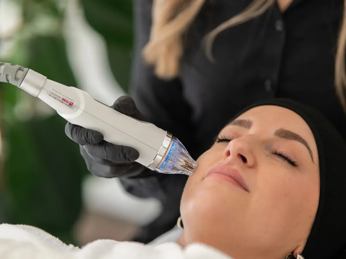 Skin Remodeling – strukturelle Hauterneuerung Bad Sassendorf
