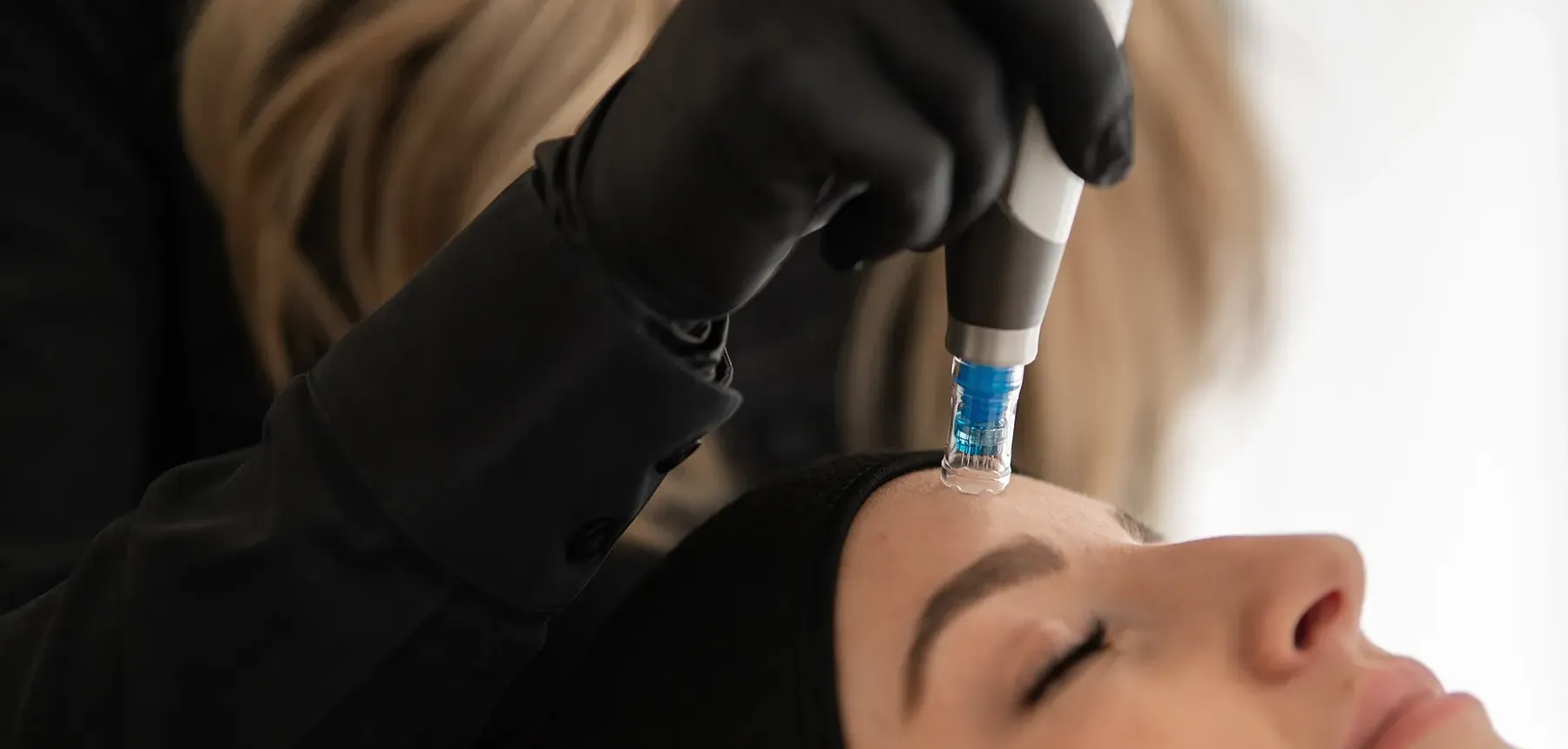 Medical Needling Bad Sassendorf
