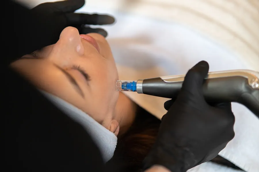 Medical Needling Behandlung